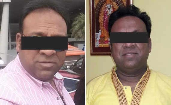 Before & After Hair Transplantation - Patient 6